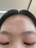 维特丝壬二酸15%凝胶祛痘膏祛痘印淡痘印水杨酸胶态硫烟酰胺乳青春期 实拍图