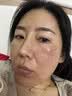 维特丝377面霜乳液男女士美白祛斑紧致高保湿补水去黄提亮黑色素护肤品 实拍图