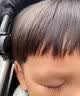华美科医用重组人体表皮生长因子点痣疤痕修复凝胶烫软膏伤口愈合15g1支 实拍图