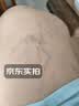 霍悉医生（DR HAWCISLN）静脉曲张专用蚯蚓腿疏通血管精索冷敷凝胶可搭二级弹力袜子非膏药 实拍图