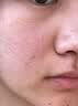 婴儿油收缩毛孔精华液去黑头深层清洁毛孔粉刺按摩保湿正品滋润油 100ml1瓶【婴儿椰子油】收缩毛孔 实拍图