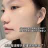 Newliann医用械字号面膜胶原蛋白冷敷贴医美术后修复保湿补水祛痘晒后修护 实拍图