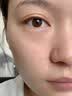 温博士去黑头水杨酸面膜清洁泥膜粉刺闭口收缩毛孔修复深层涂抹式 实拍图