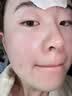 优理氏 寡肽冻干粉精华液祛痘淡化痘印痘坑毛孔收缩次抛男女士修护粉刺 实拍图