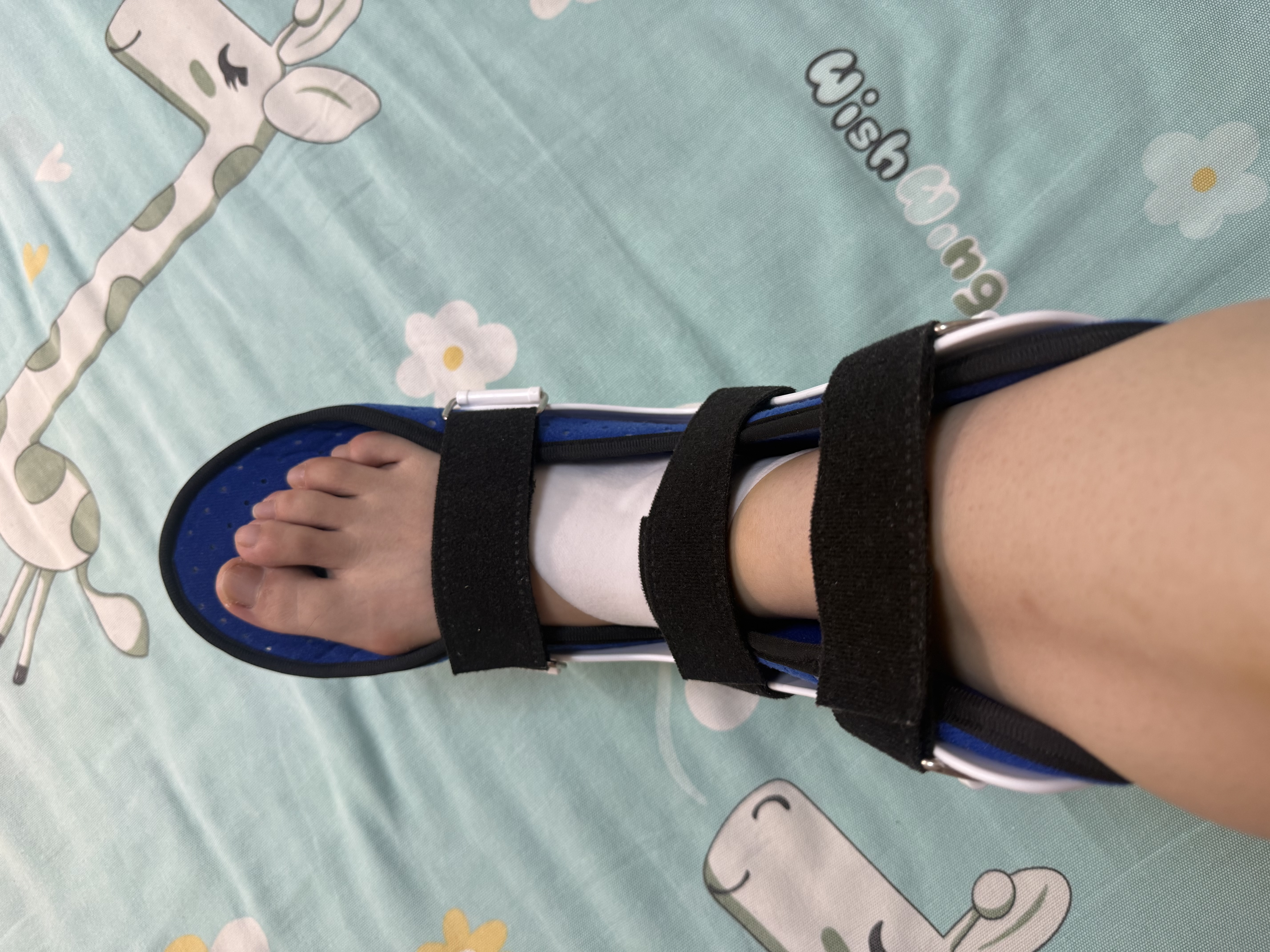 冠爱（GUANAI）医用踝关节固定支具脚踝跖骨脚面骨折扭伤支架护具康复护踝石膏鞋 实拍图
