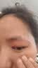 倍舒痕舒痕进口硅凝胶scar free祛疤膏摔烫增生瘢痕术后外伤儿童可用30g 实拍图