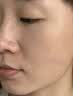 高坂制药点痣膏点斑祛疣药水脸部去黑痣扁平跖疣修复液无痕不留疤非药5ml 实拍图