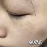 BEAUTY NOTES氨甲环酸精华液传明酸湿敷水医黄褐斑用烟酰胺美肤白淡暗沉斑 实拍图