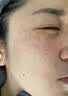 [九芝堂]逍遥丸(浓缩丸) 200丸 5盒装 疏肝解郁黄褐斑祛斑专用中成药男女士内调去黄褐斑雀斑晒斑老年斑色斑胶囊口服 中药调理 脸上长期长各种斑 实拍图