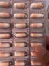 舒尔佳奥利司他胶囊120mg*63粒 减脂减重 排油瘦身 治疗肥胖 国药准字 减肥药 中国专利金奖 抑制脂肪 塑身 实拍图