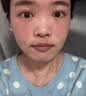 Newliann医用械字号面膜胶原蛋白冷敷贴医美术后修复保湿补水祛痘晒后修护 实拍图