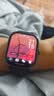 小米（MI）REDMI Watch 5 典雅黑心率血氧监测 蓝牙通话红米手表5 24天超长续航智能手表男女 实拍图