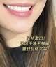 袋鼠杰克游泳去氯漱口水便携式泳后除氯除菌清洁口腔儿童适用12ml*20条 实拍图