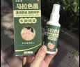 祥醫堂马拉色菌专用毛囊喷雾头皮部毛囊炎痒有红疙瘩前胸后背除螨痘 实拍图