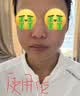 雅漾（Avene）【王安宇推荐】专研密集修护面膜5片 超修小白膜舒缓晒后补水男女 实拍图