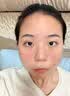 维特丝芦荟胶补水保湿晒后修复凝胶面霜祛痘印收缩毛孔烟酰胺男女士 实拍图