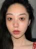 白云山眼部抗皱植萃精华油紧致淡化细纹眼袋黑眼圈补水保湿两瓶装40ml 实拍图