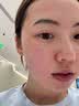 华美科医用修复皮肤屏障受损泛红修护乳液全能面霜补水保湿械字号1支 实拍图