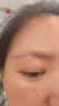 倍舒痕舒痕进口硅凝胶scar free祛疤膏摔烫增生瘢痕术后外伤儿童可用30g 实拍图