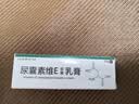 周郎中尿囊素维E乳膏软膏尿囊素霜身体乳抑菌乳膏 20g 实拍图