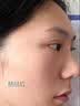 Newliann医用冷敷贴面膜械字号敷料重组胶原蛋白晒后修复医美术后补水保湿 实拍图