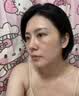 EDRI氨甲环酸祛斑乳膏医美用祛斑霜美白淡化黑色素黄褐斑雀斑晒斑男女 实拍图