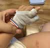 富瑞卡（FairyCare）防吃手手套宝宝戒吃手矫正神器婴儿童防咬指甲拇指+食指蓝色XM码 实拍图