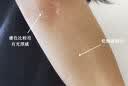 维特丝果酸磨砂膏身体美白去鸡皮肤去角质嫩白全身去死皮男女士搓澡泥宝 实拍图
