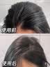 维特丝洗发水男女士专用去屑止痒控油持久蓬松留香洗头膏发露金榜第1名 实拍图