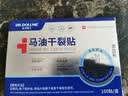DR.DOLLME 朵美博仕德国凡士林马油干裂贴防护手指足部干裂冻疮皲裂愈合医护级胶布 实拍图