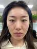 维特丝377面霜乳液男女士美白祛斑紧致高保湿补水去黄提亮黑色素护肤品 实拍图