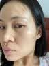 华美科VC烟酰胺美白精华液祛斑淡化黑色素提亮抗氧医男女士用熊果苷原液 实拍图