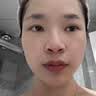 村濑制药点痣膏无痕脸部祛痣点斑点疣药水去黑痣专用脸部不留疤正品修复液 实拍图