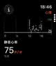 Apple/苹果/苹果 Watch S11 智能手表GPS+蜂窝款46毫米玫瑰金色铝金属表壳淡桃粉色运动型表带S/M MFDG4CH/B 实拍图