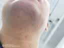 【原研】百多邦 莫匹罗星软膏2%*15g 脓疱病疖肿毛囊炎湿疹 实拍图