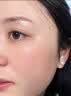 EDRI氨甲环酸祛斑乳膏医美用祛斑霜美白淡化黑色素黄褐斑雀斑晒斑男女 实拍图