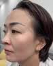 EDRI氨甲环酸祛斑乳膏医美用祛斑霜美白淡化黑色素黄褐斑雀斑晒斑男女 实拍图