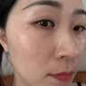 EDRI氨甲环酸祛斑乳膏医美用祛斑霜美白淡化黑色素黄褐斑雀斑晒斑男女 实拍图