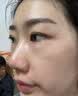 LEKKI美白祛斑霜淡化黑色素去斑去雀斑黄褐斑晒斑女男士护肤品生日礼物 实拍图