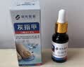 阪町製薬灰指甲真菌感染脱甲坏甲增厚发黄变厚变空特效专用亮甲20ml*1盒 实拍图