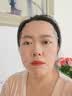 沃朗森医用面膜械字号冷敷贴医美术后补水修复祛痘印消炎透明质酸钠3盒 实拍图