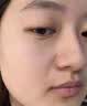 高坂制药点痣膏点斑祛疣药水脸部去黑痣扁平跖疣修复液无痕不留疤非药5ml 实拍图