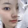 Newliann医用械字号面膜胶原蛋白冷敷贴医美术后修复保湿补水祛痘晒后修护 实拍图