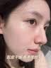 Newliann医用重组生长因子喷雾剂表皮修复皮肤屏障凝胶原蛋白人体补水保湿 实拍图