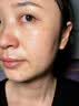 EDRI氨甲环酸祛斑乳膏医美用祛斑霜美白淡化黑色素黄褐斑雀斑晒斑男女 实拍图