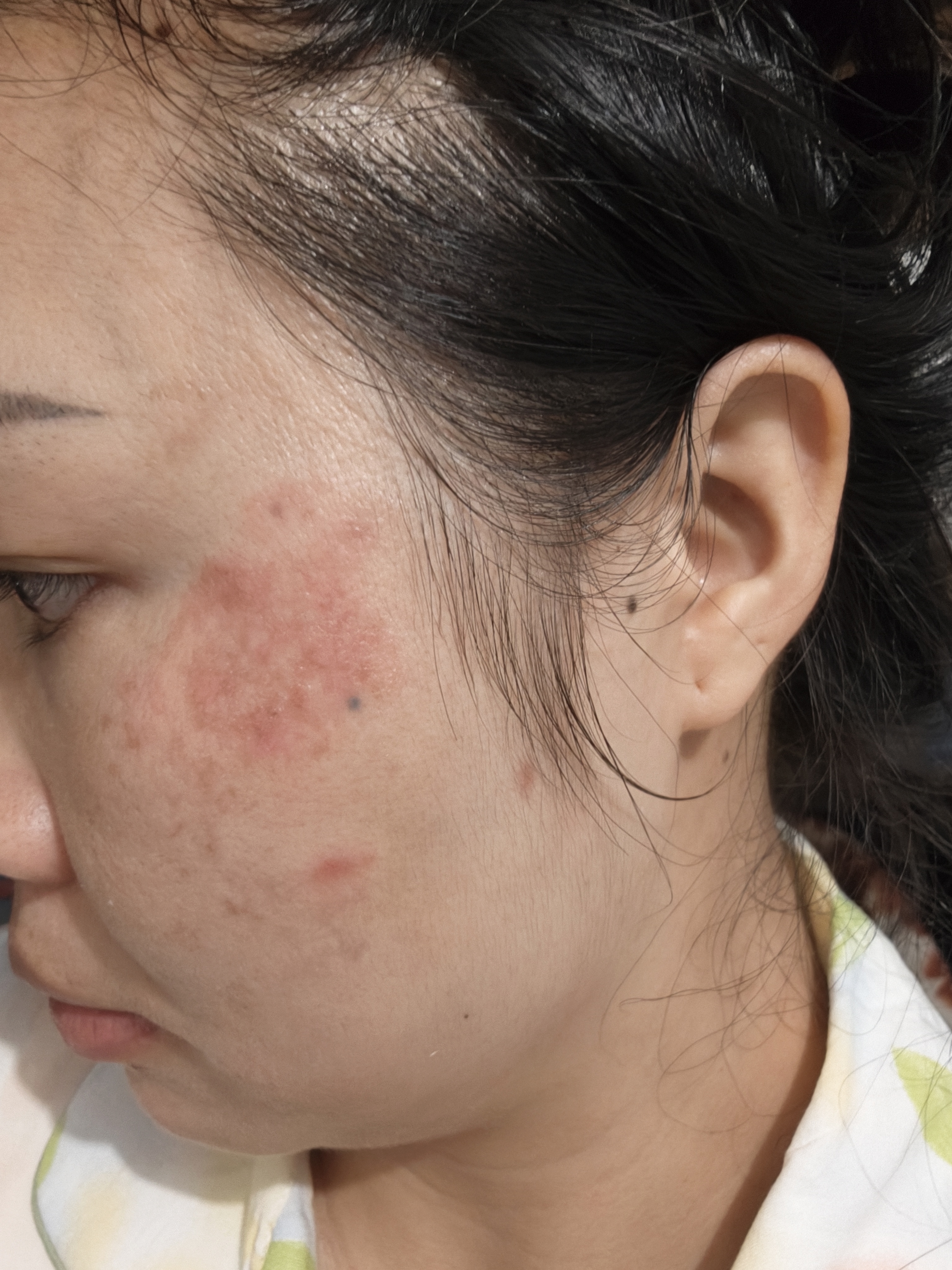 透真冻干粉修复屏障受损精华液增厚角质层多肽术后医修护褪泛红血丝 实拍图