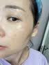 BEAUTY NOTES氨甲环酸乳霜软膏祛斑医美用祛斑霜377美白淡化黑色素黄褐斑男女 实拍图