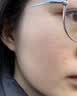 Newliann医用重组三型人源化胶原蛋白修护凝胶表皮修复敷料生长因子护理膜 实拍图