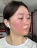 冭川制药维生素e乳膏医用尿素修复皮肤屏障正品专用皮肤干燥止痒润肤软膏 实拍图