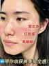 冭川制药维生素e乳膏医用尿素修复皮肤屏障正品专用皮肤干燥止痒润肤软膏 实拍图